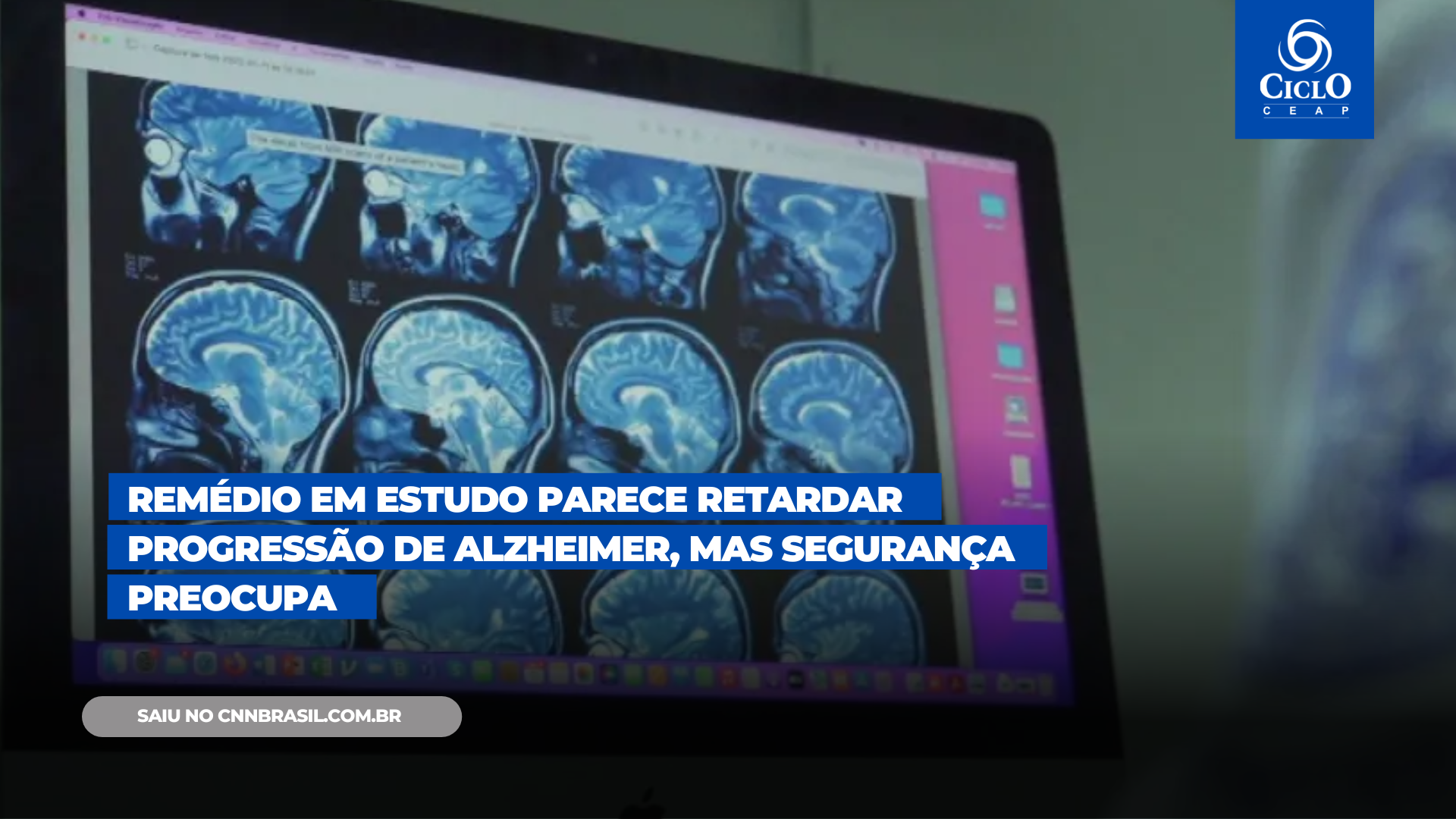 BRAIN TEST: NÍVEIS 77 a 92 RESOLVIDOS! 